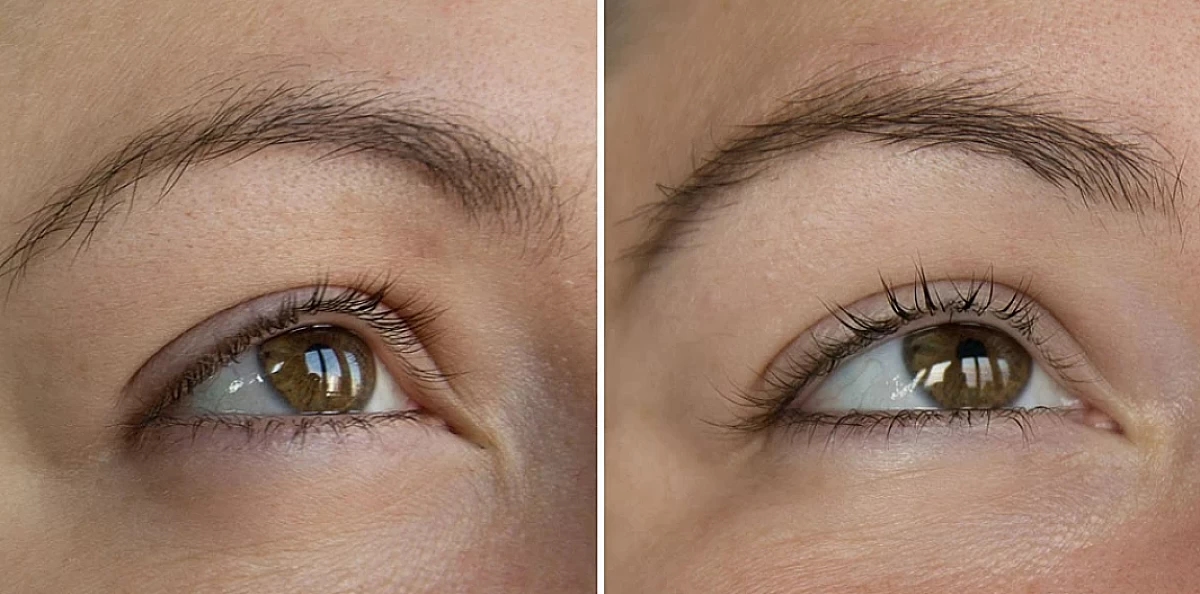 Picture of eyes