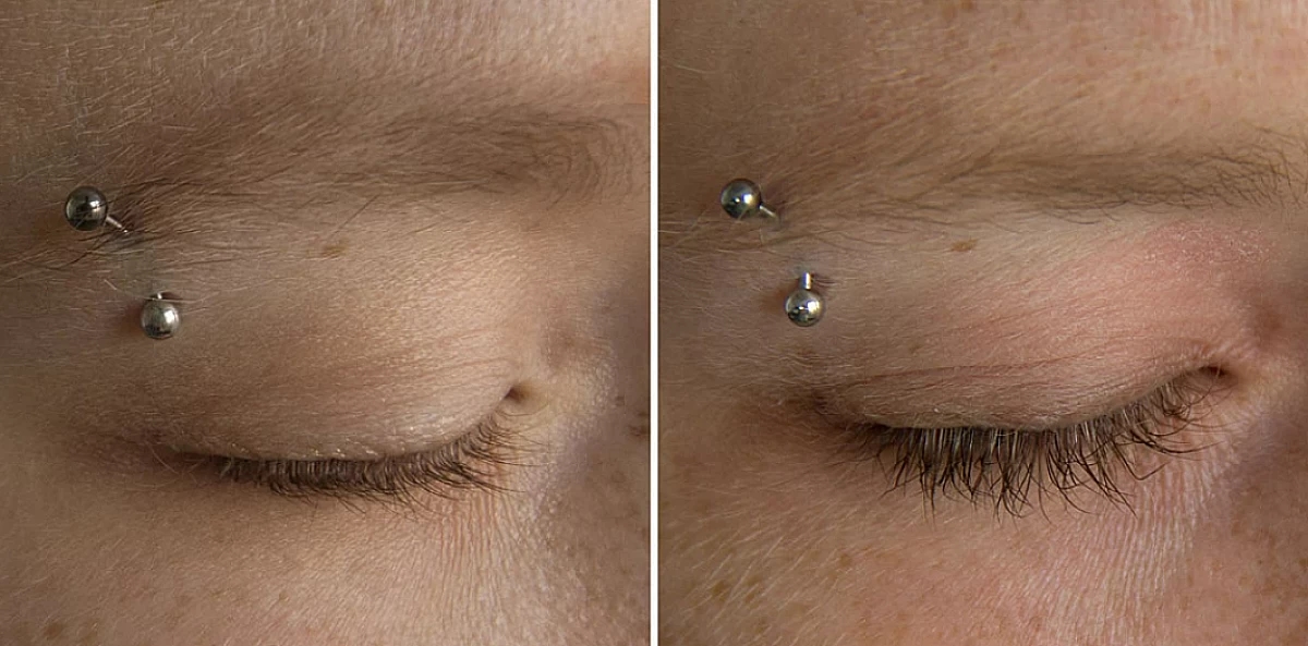Picture of eyes