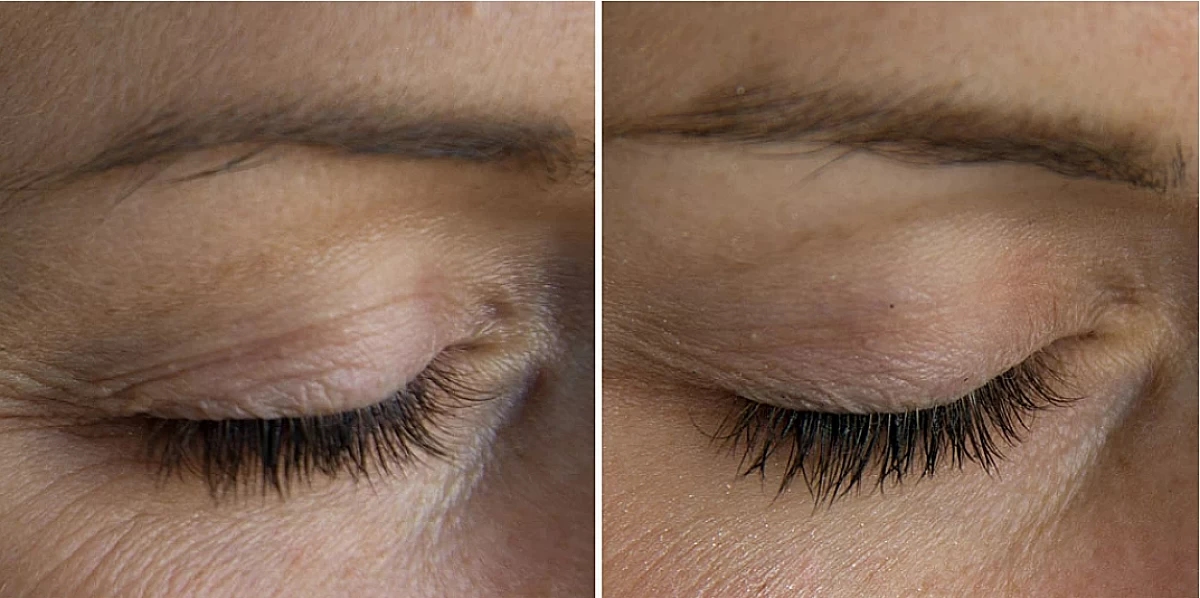 picture of eyes