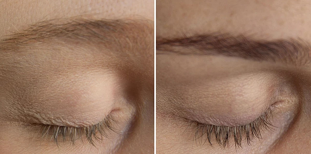 Picture of eyes