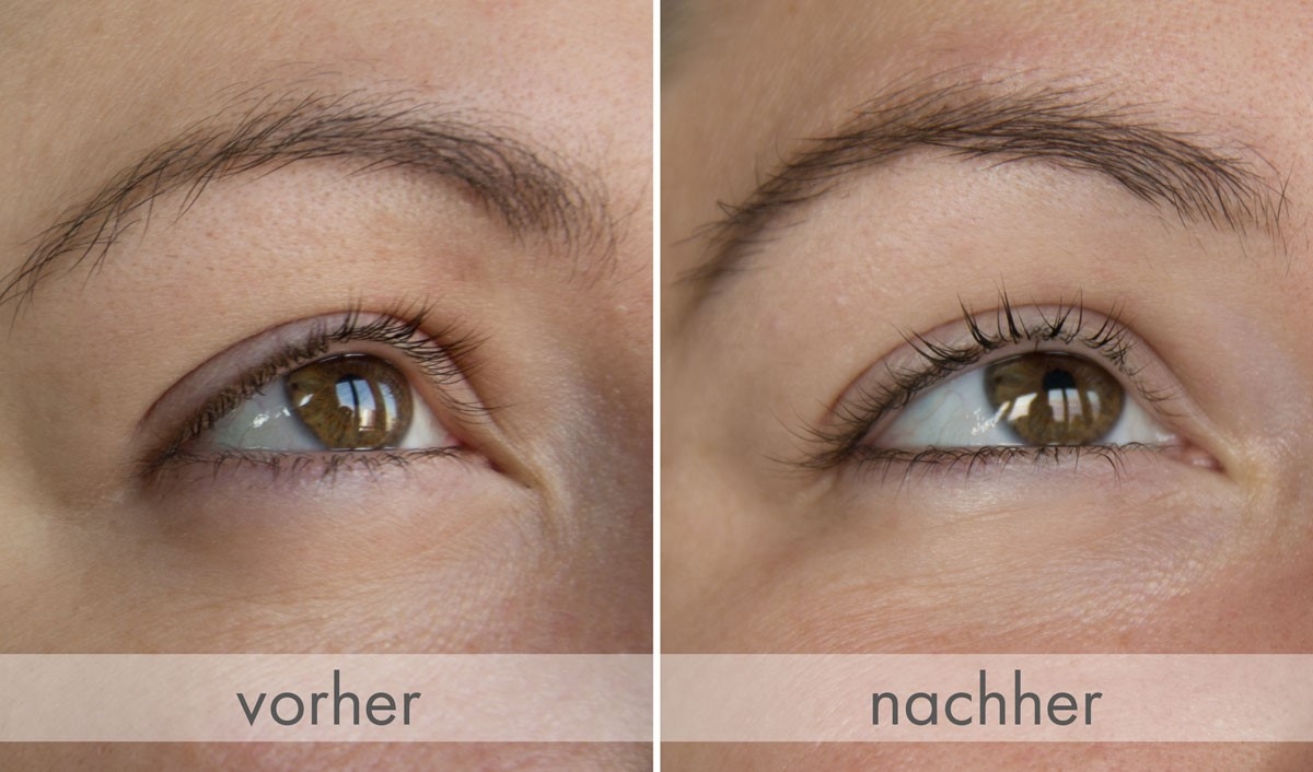 La comparaison avant / après