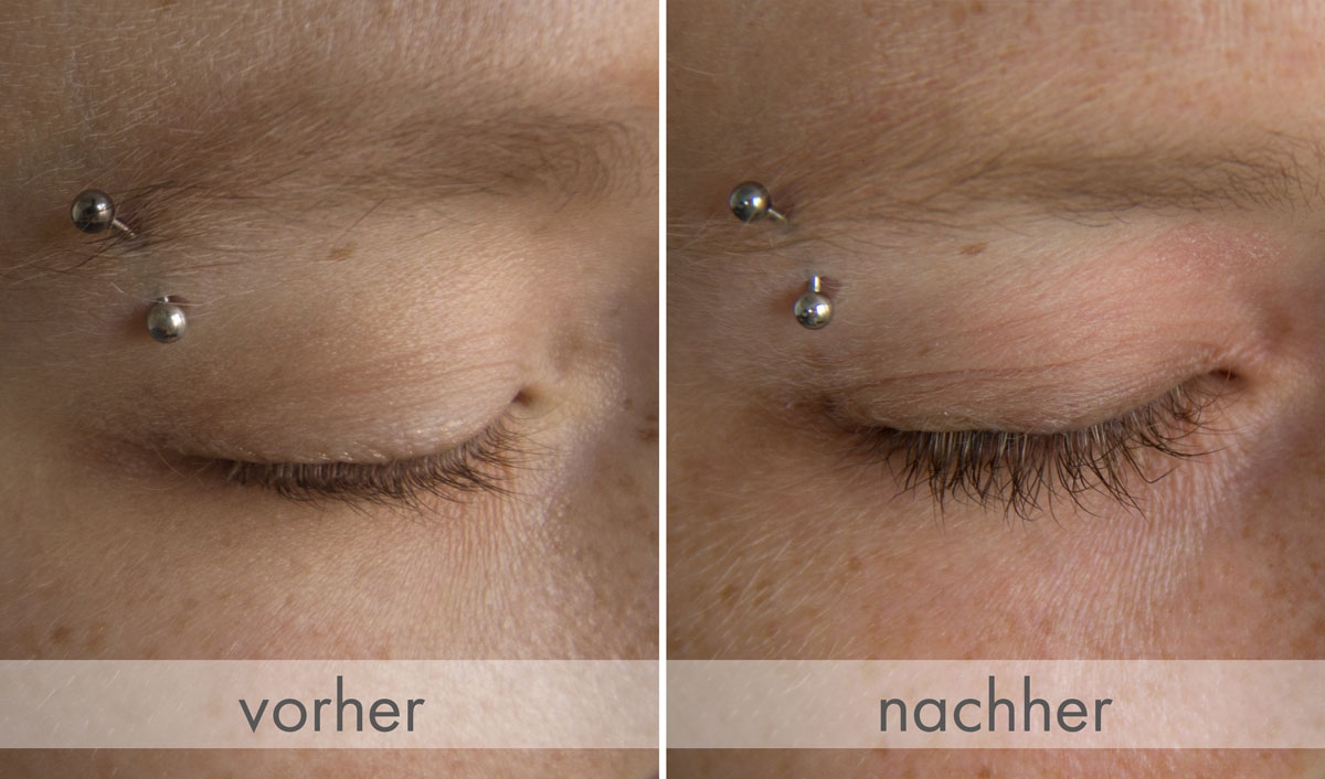 La comparaison avant / après