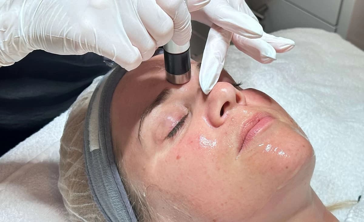 An ultrasound device is passed over the skin.