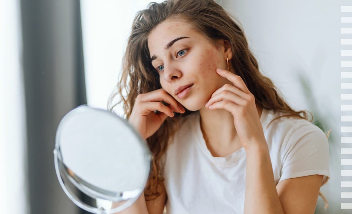 The best tips against facial redness