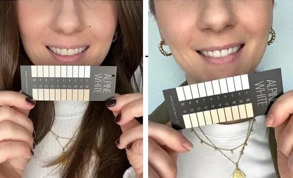 Des dents plus blanches avec Alpine White: avant / après